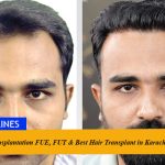Experienced surgeon performing advanced hair transplant procedure at Hash Clinics in Karachi